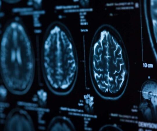 brain-scan 1
