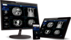 dicom-viewer-laptop-phone-tablet